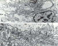 Euopisthobranchs.JPG