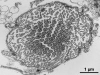 Spirorbis PN TC quer TEM_1µm.jpg