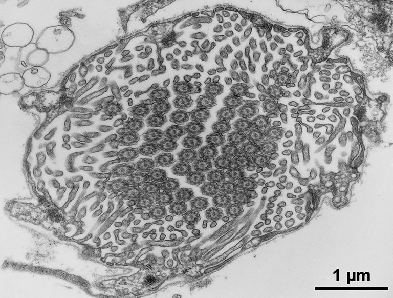Spirorbis PN TC quer TEM_1µm.jpg